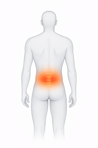 Representación del dolor lumbar localizado en la parte baja de la espalda