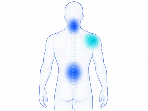 Ilustración de las zonas corporales más afectadas por trastornos musculoesqueléticos laborales: columna lumbar, cuello y hombro